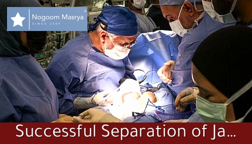 Successful Separation of Jamaican Twins Azaria and Azura in Riyadh