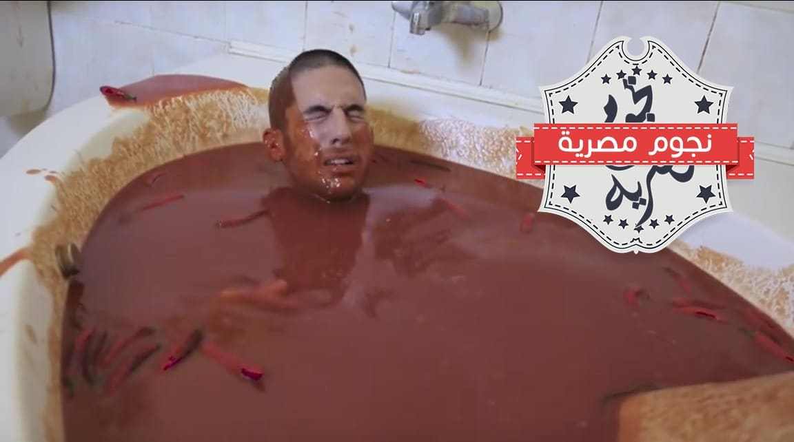 بالصور شاهد ماذا حدث لشاب قرر الإستحمام في الصلصة الحارة ! (4)