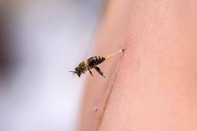 العلاج بسم النحل في مصر...وكالة الأنباء الفرنسية تنشر مجموعة من الصور