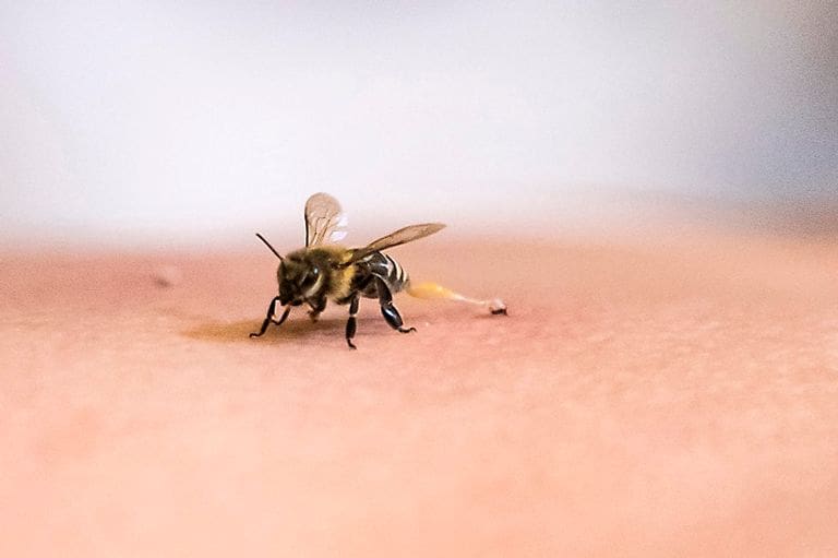 العلاج بسم النحل في مصر...وكالة الأنباء الفرنسية تنشر مجموعة من الصور