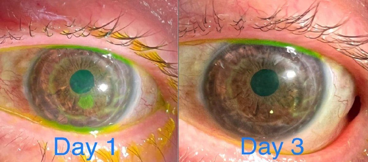 طبيب عيون يكتشف ميزة مثيرة في كاميرا iPhone 13 Pro Max 