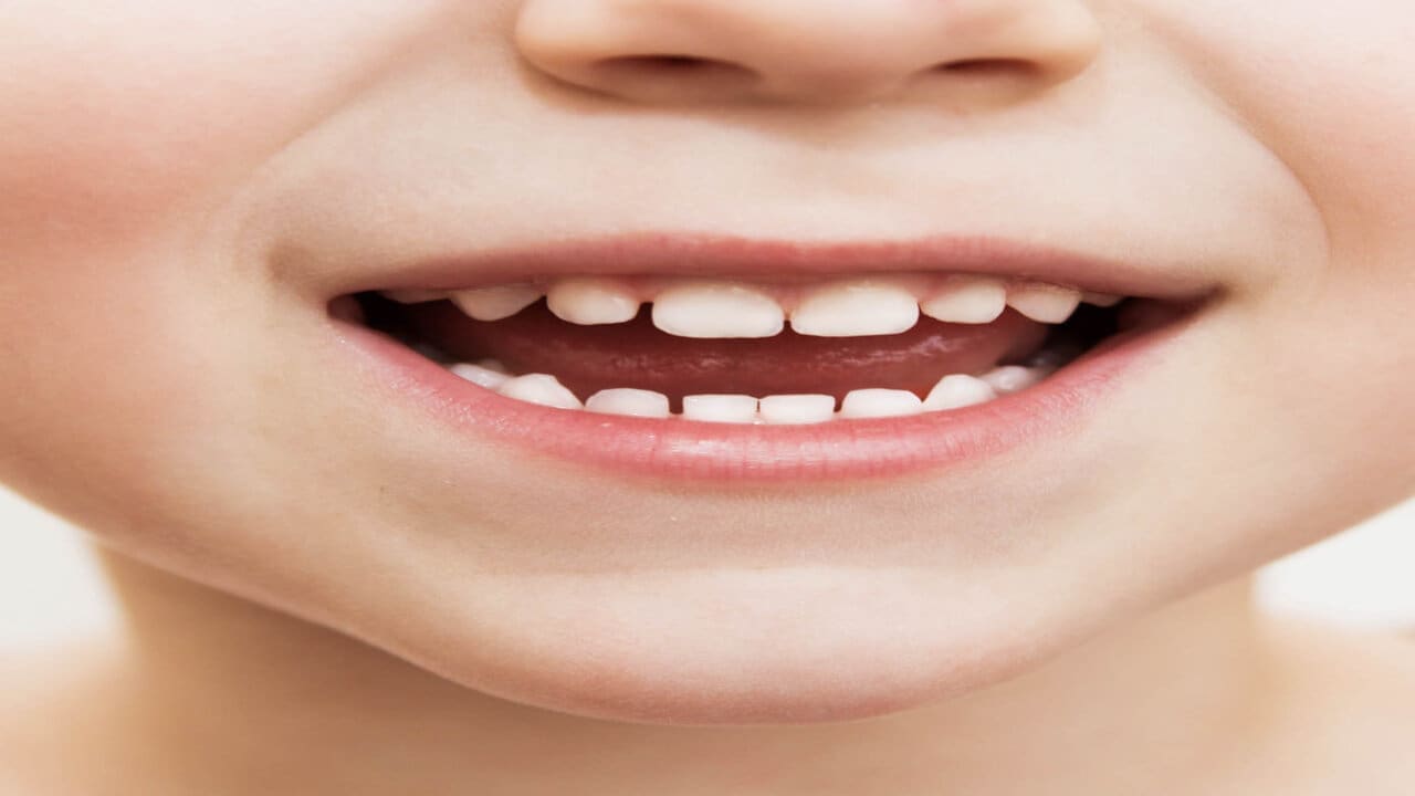 صورة للأسنان اللبنية للأطفال 