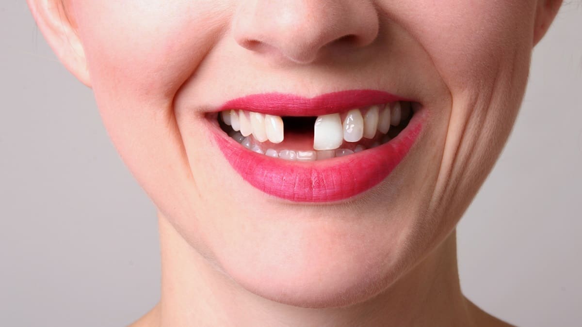 Египетийн одод | Ганц бие эмэгтэйн гарт байгаа шүд нь доод эсвэл дээд хэсэгт өвдөлтгүй унасан тухай мөрөөдлийн тайлбар
